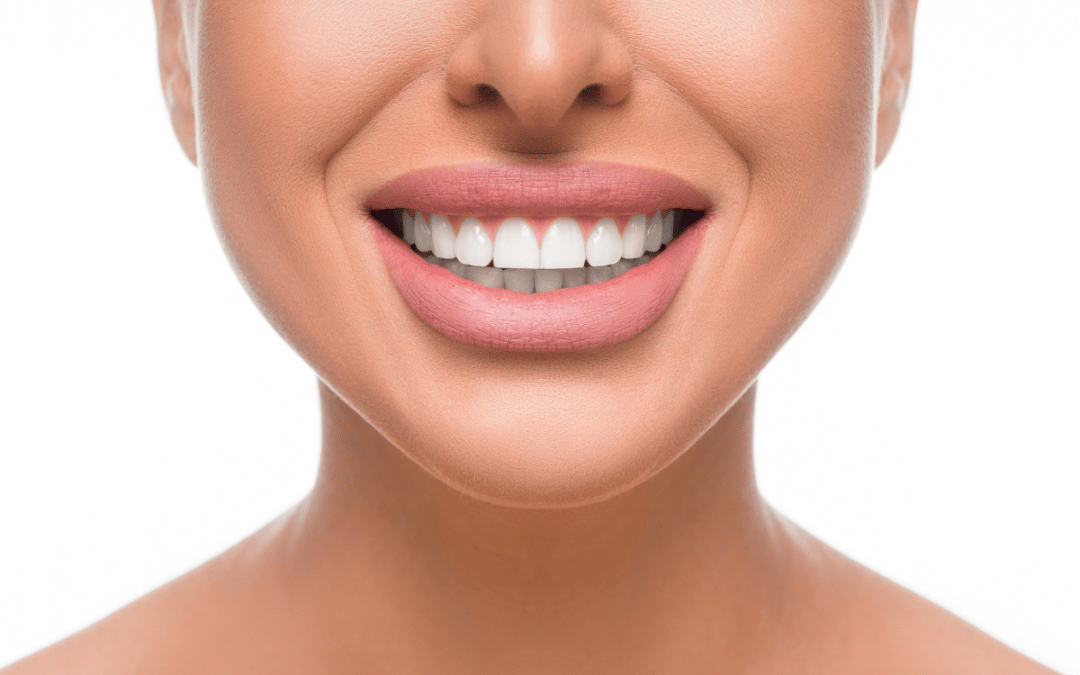 A Closer Look at Dental Veneers